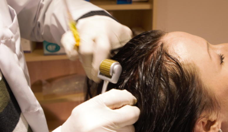 Mesotherapy, Hair Clinic