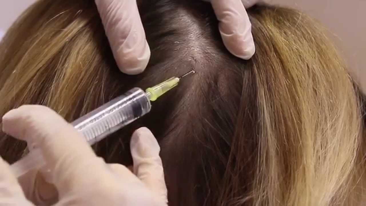Rangwala Hair Growth, Hair Treatment